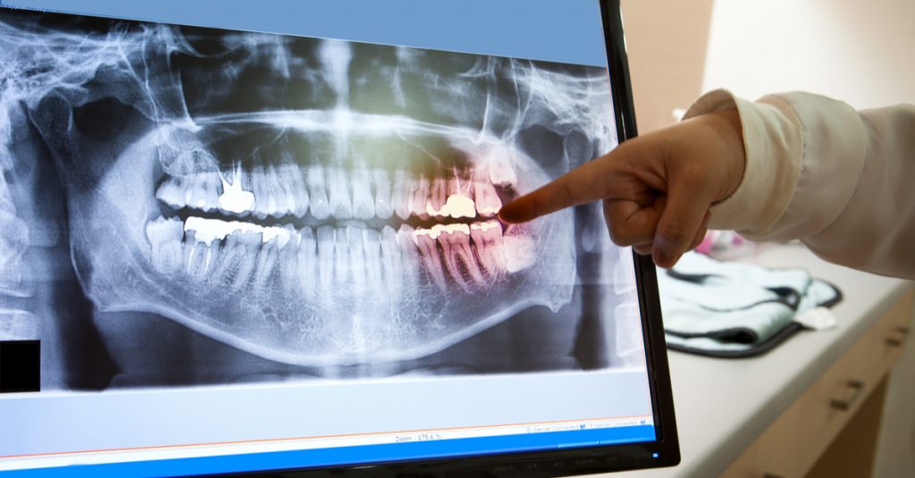 The Value of Radiography in Dentistry
