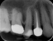 The Value of Radiography in Dentistry