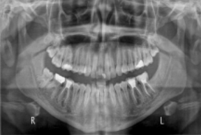 The Value of Radiography in Dentistry