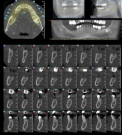 The Value of Radiography in Dentistry