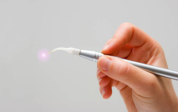 Laser Applications in Dentistry