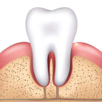 Periodontal Treatment